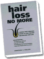 Hair Loss No More