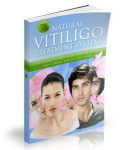 The Natural Vitiligo Treatment System [TM]